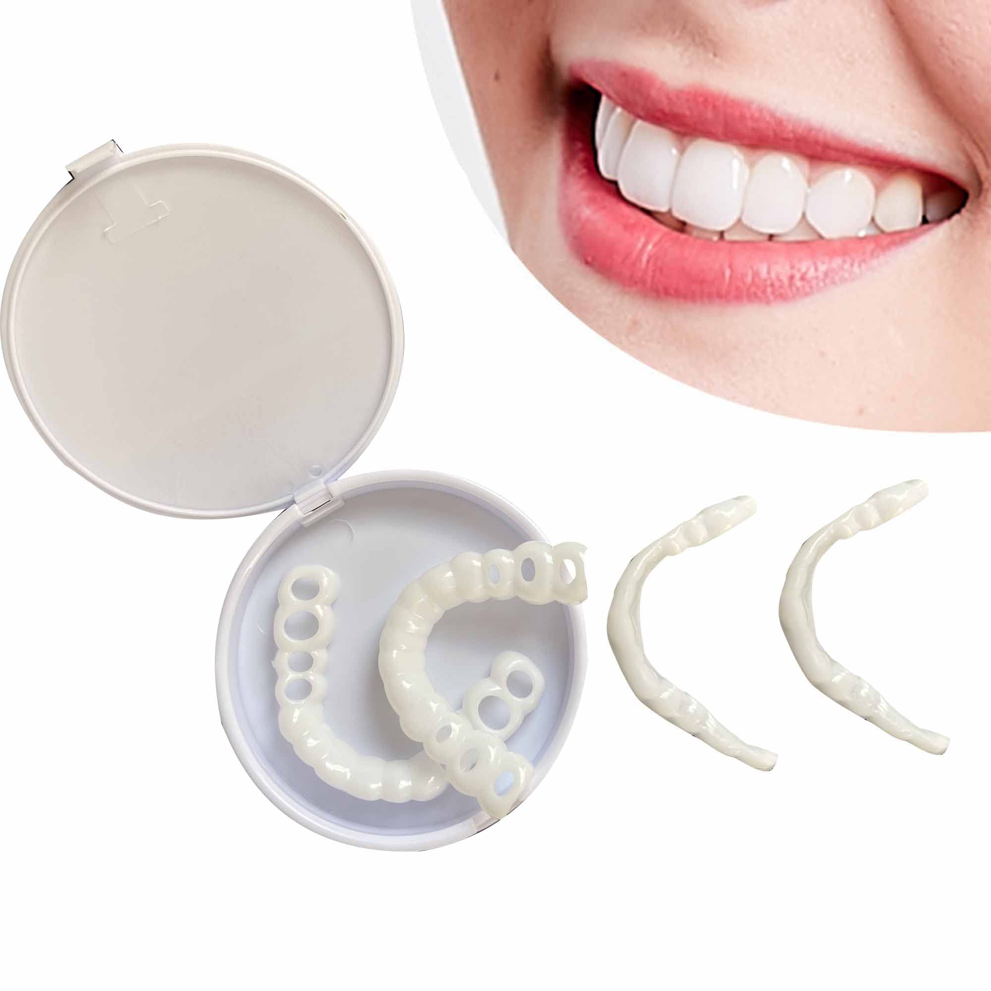 Huihaochenggong Temporary White Teeth Cover for Imperfect Teeth ...