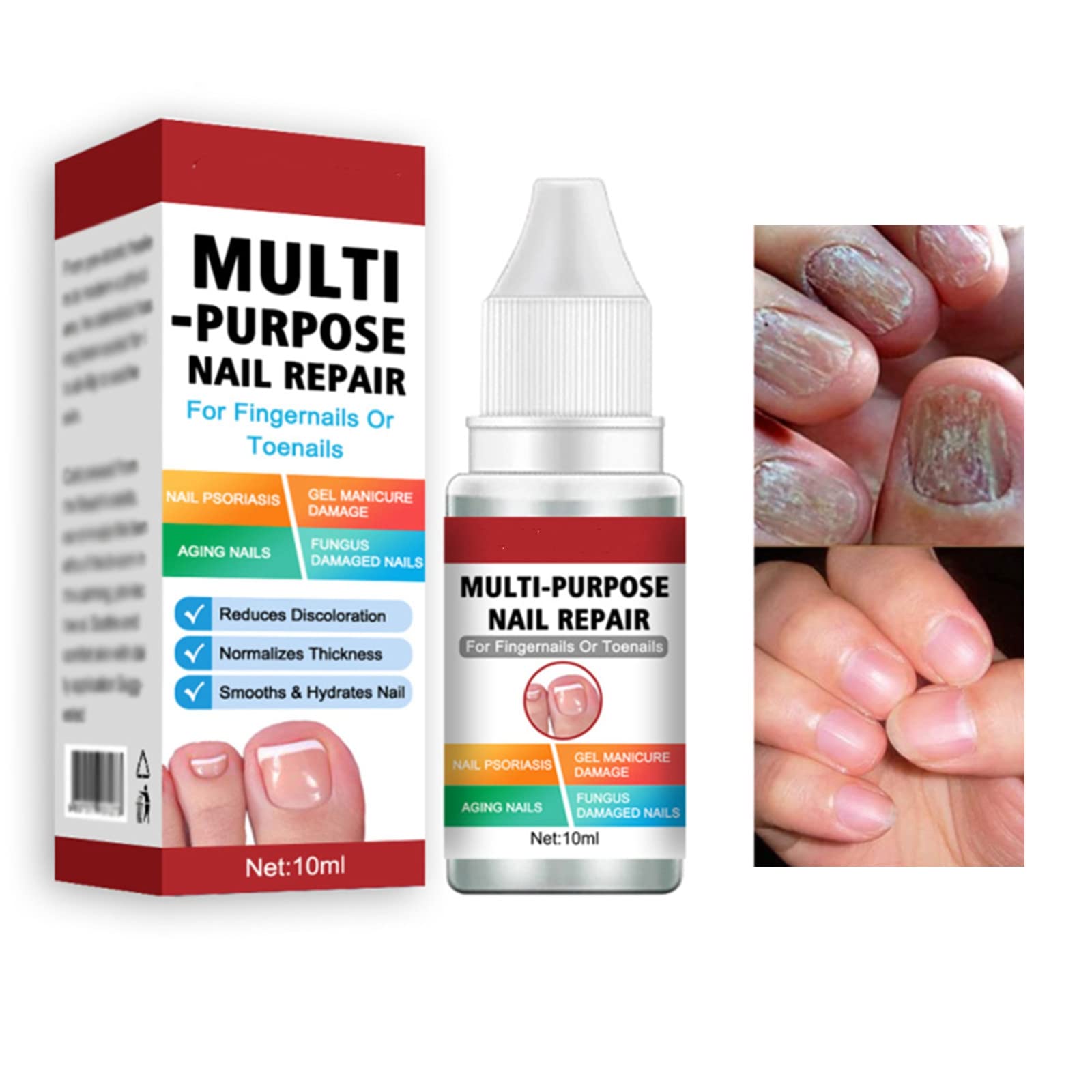 What Is Bond Aid For Nails|5ml Nail Gel Repair Kit - Cracked Nail Extension  Treatment With Base Coat