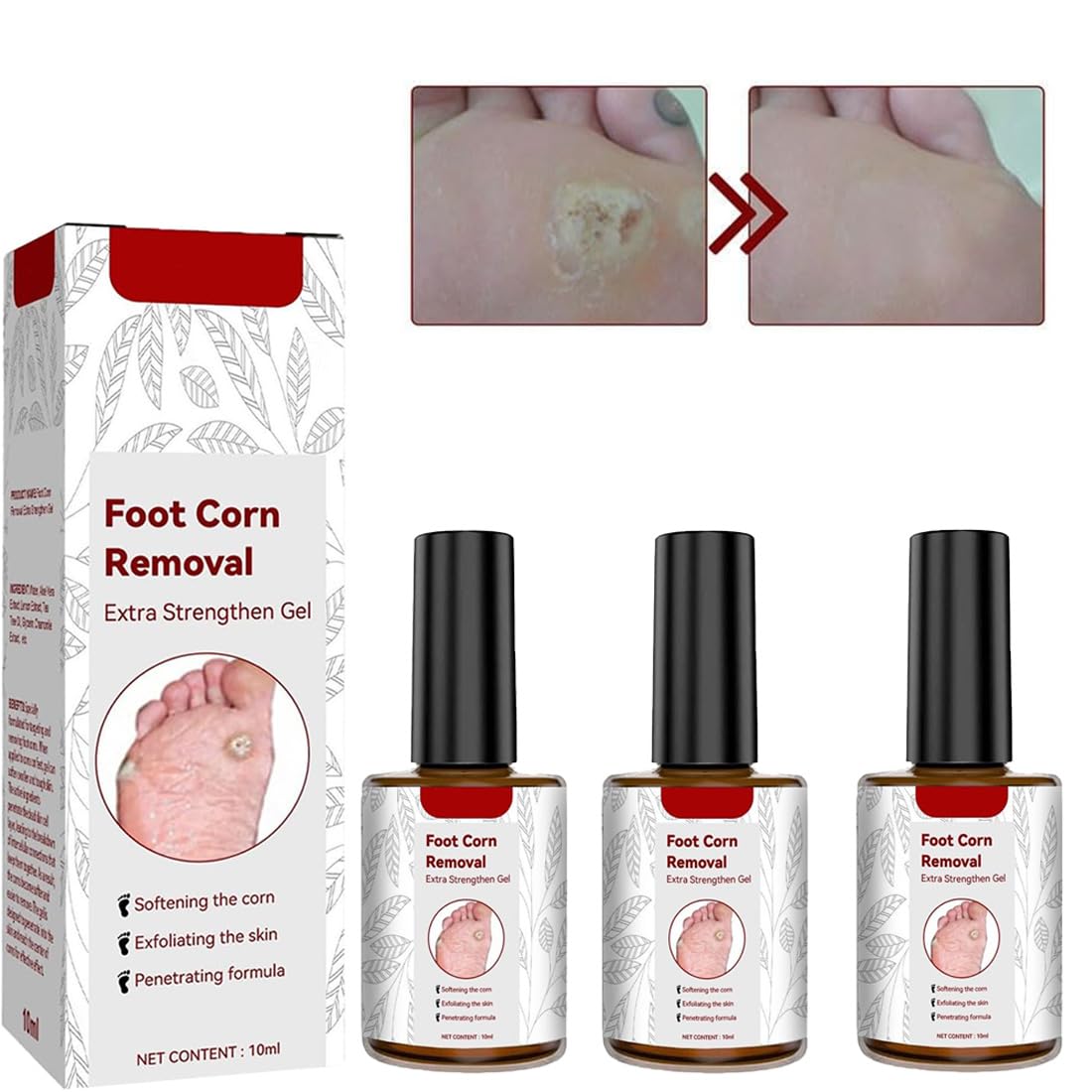 Foot Corn Removal,Extra Strengthen Gel Quick Corn Remover Liquid Mild Corn  Callus Remover for Feet