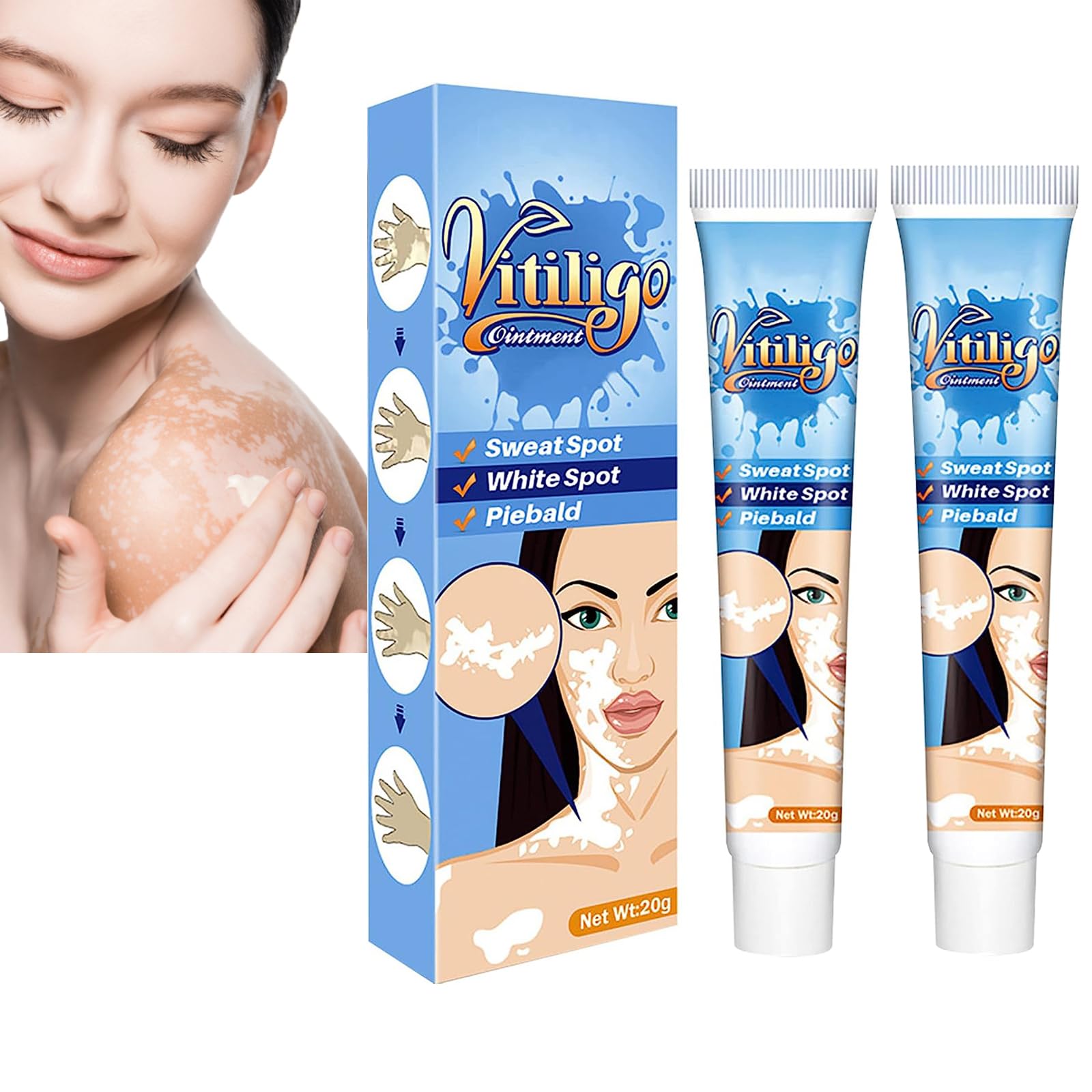 Vitiligo Therapy Cream Vitiligo Treatment Vitiligo Care Cream for