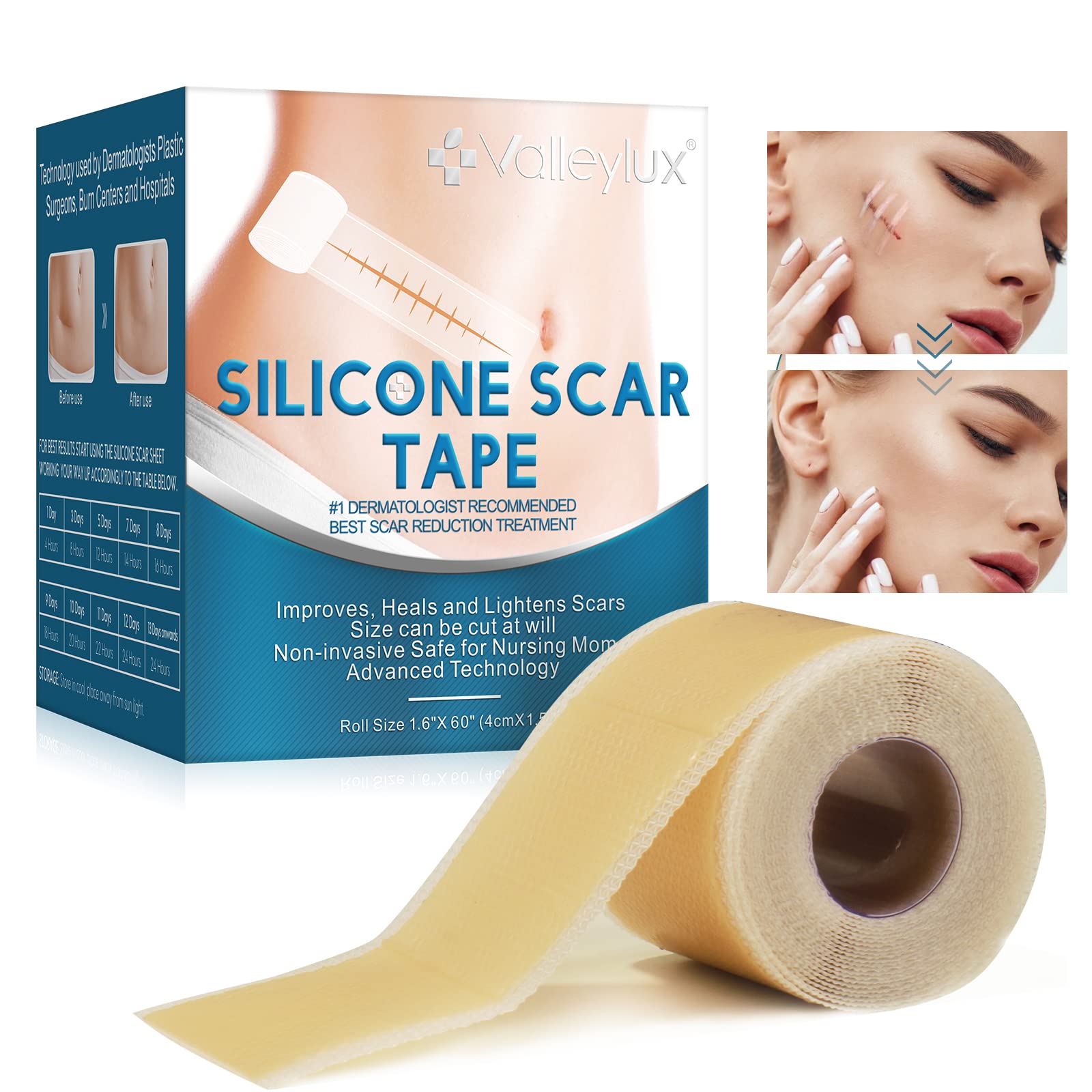 Advanced Silicone Scar Tape - Medical Grade Soft Silicone Gel Tape Scar  Removal, 1 Roll, 1.6x60