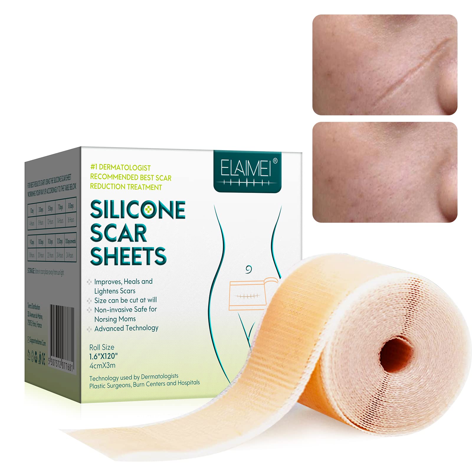 Silicone Scar Sheets Professional For Scars Caused By C-section Surgery  Burn