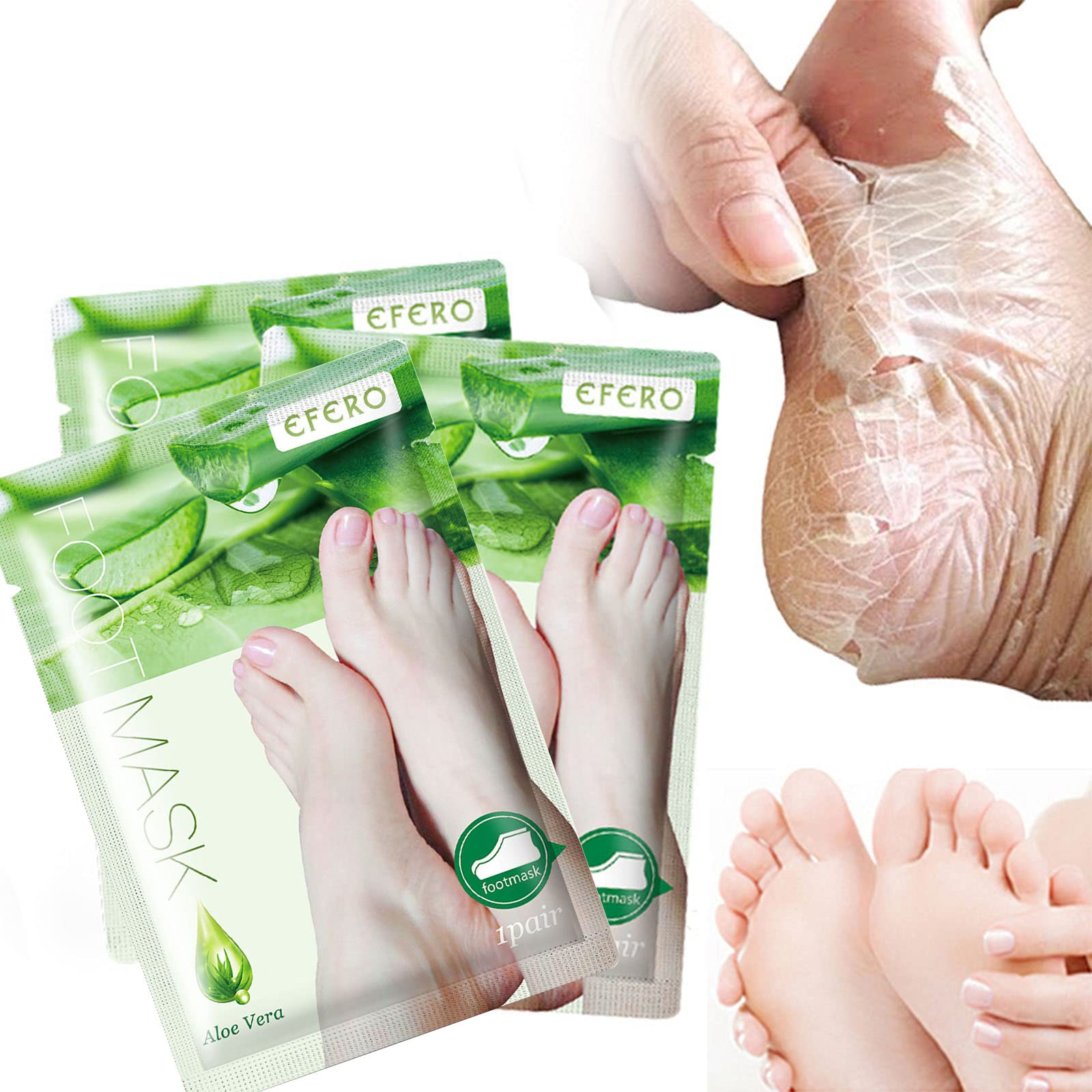 Earth Therapeutics Aloe Vera Socks – Infused with Natural Aloe Vera &  Vitamin E – Helps Dry Feet, Cracked Heels, Calluses, Rough Skin, Dead Skin  - Use