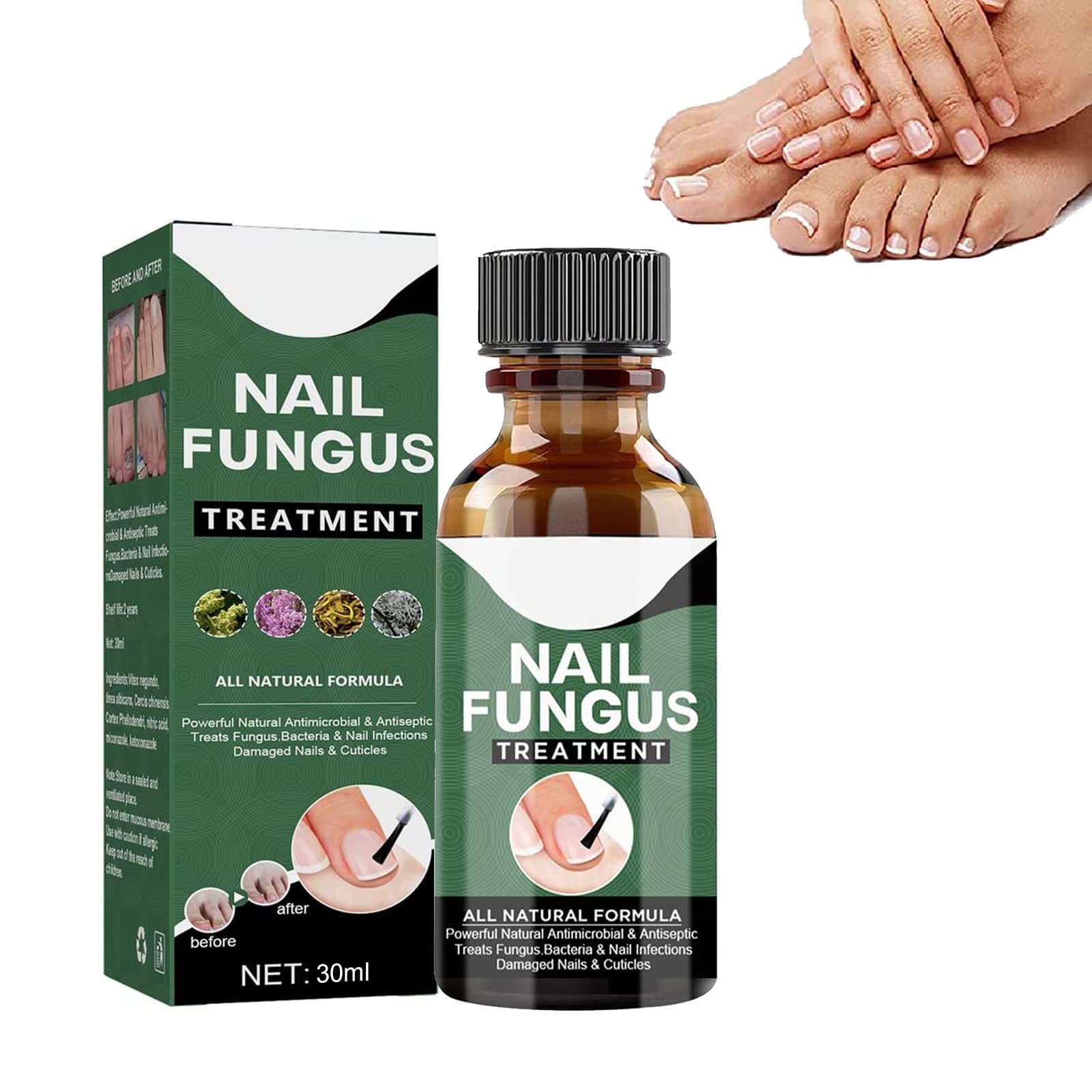 Buy Hongosan Antifungal Nails and Skin Full Kit Original 8 Products Super  Especial Value Packhongosan El Original Online at desertcartINDIA