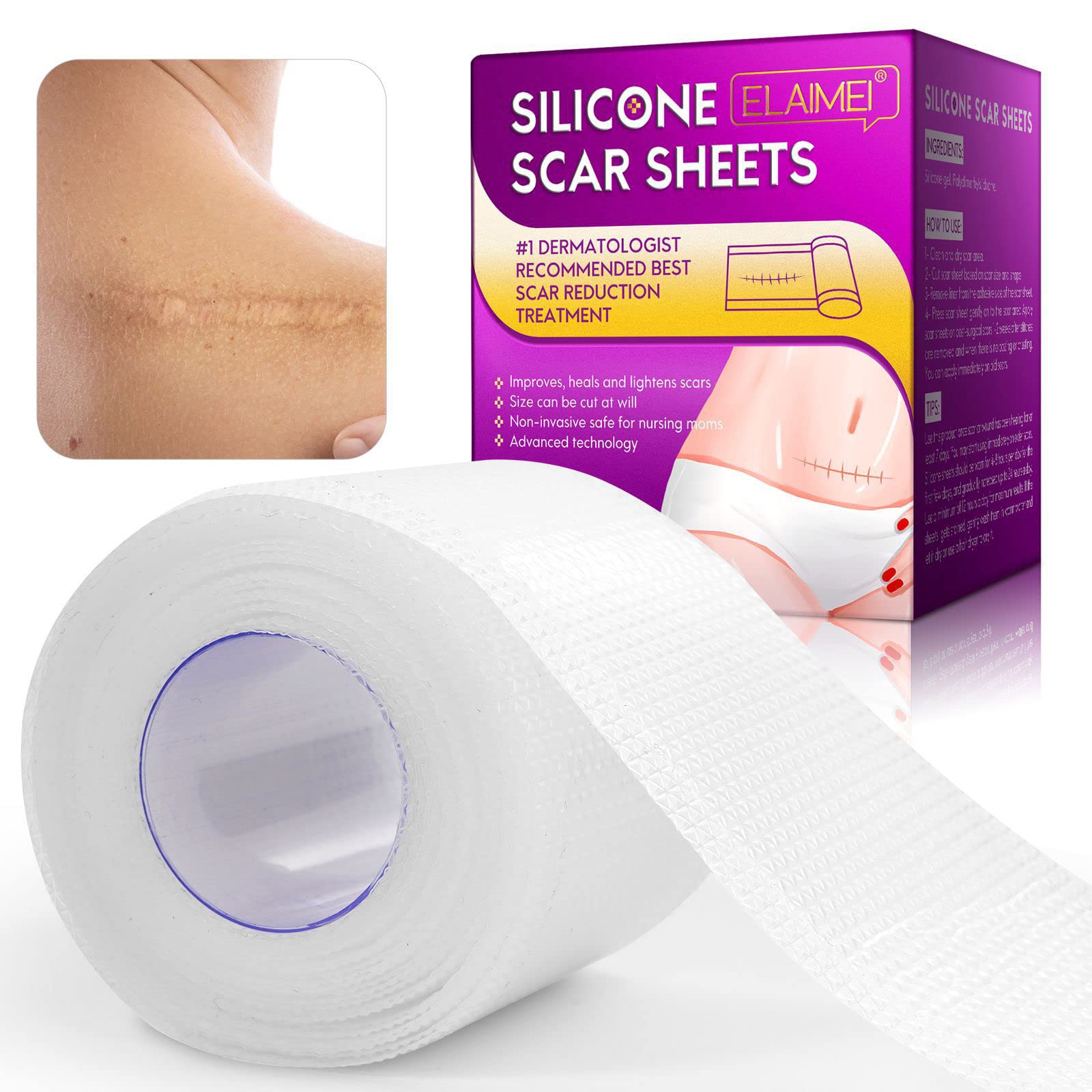 ScarAway Silicone Clear Scar Sheets