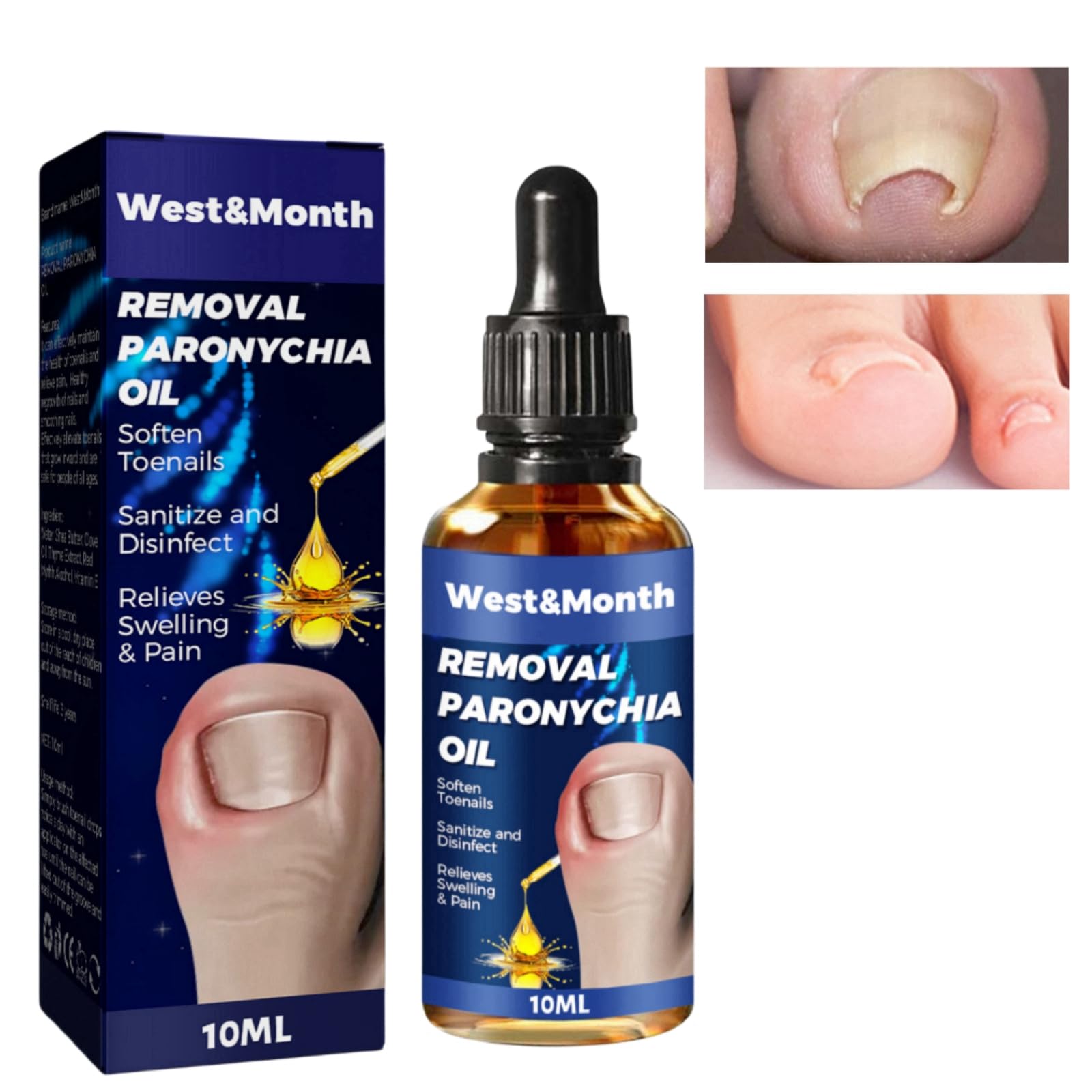 Podiatrist On Call, LLC - PAINLESS and SURGERY-FREE INGROWN TOENAIL  TREATMENT Introducing… The Onyfix nail correction system. It is a versatile  and innovative product that enables completely painless treatment of almost  all