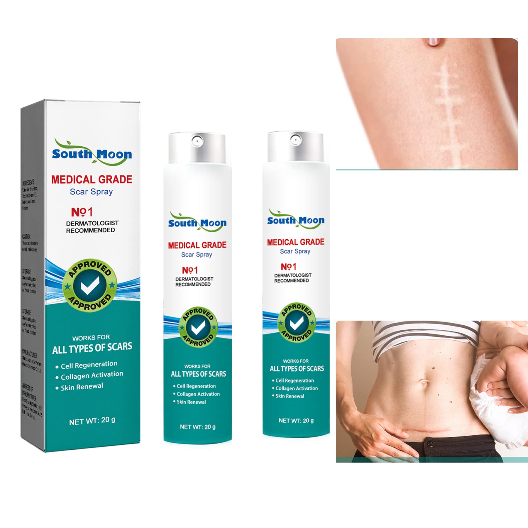 Scar Remove Medical Grade Scar Spray Scar Remove Advanced Spray ...