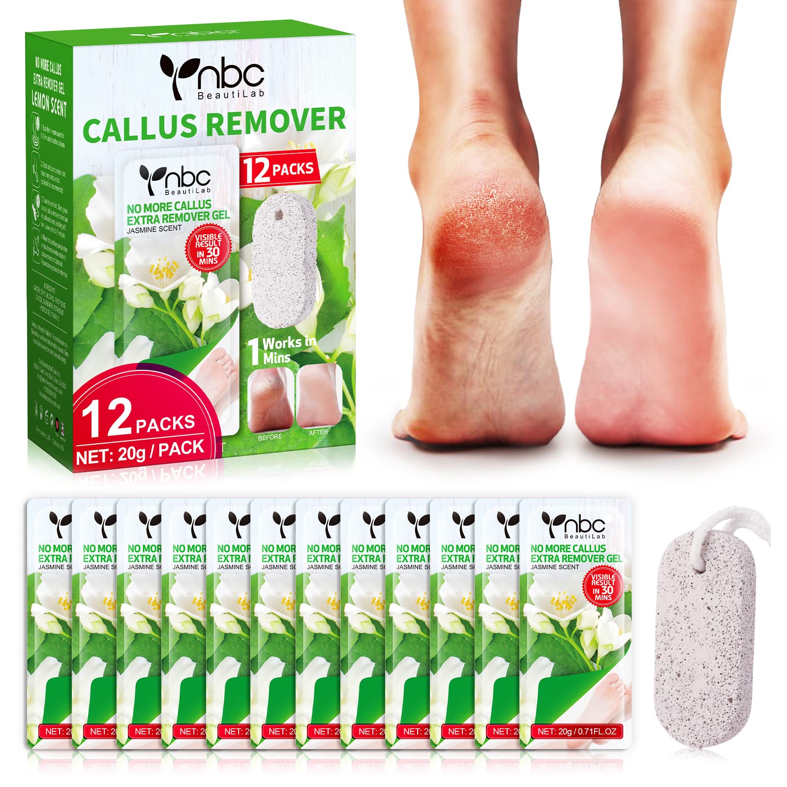 Daily Remedy Citrus Detox Callus Remover Gel & Pumice Stone for Feet -  Extra Strength Professional Scrubber, Remove Tough Calluses, Dead Skin, Dry  Cracked Heels - Home Pedicure Products for Feet Gel + Pumice