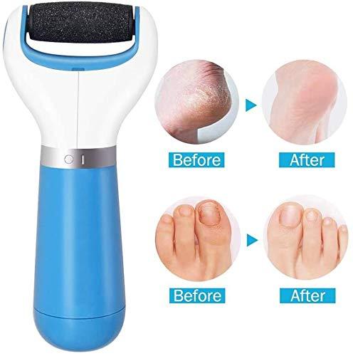 Electronic Pedicure Foot File Callus Remover Rechargeable - Blue or Pu –  DealJock
