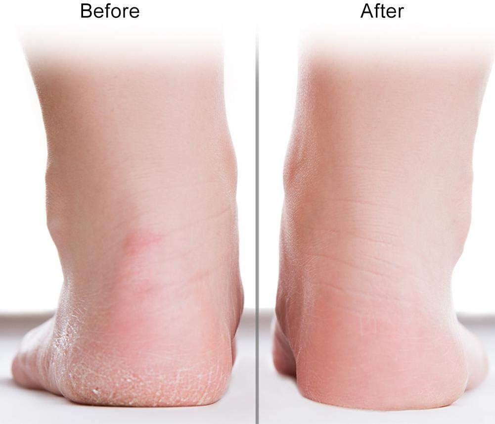 MOUNTAINOR Silicone Gel Heel Socks For Dry Hard Cracked Heel Repair Pad -  Pink Reviews Online | Nykaa