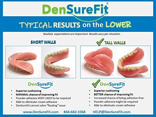 DenSureFit - IT'S TRUE 👀 Denture wearers should not use