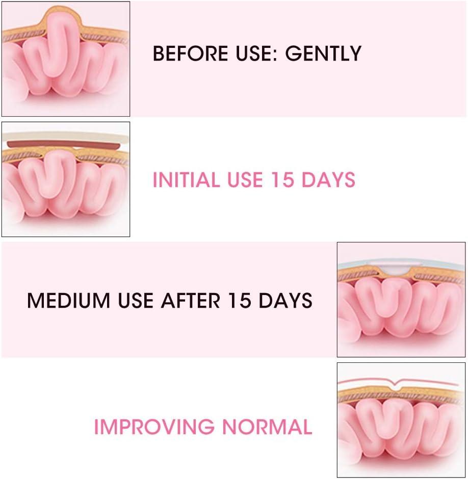  Yinhing Umbilical Hernia Belt, 2pcs Cotton Baby Infant Umbilical  Cord Belly Band Newborn Navel Belt Umbilical Cord Kids Support Wrap  Protector(Pink) : Baby