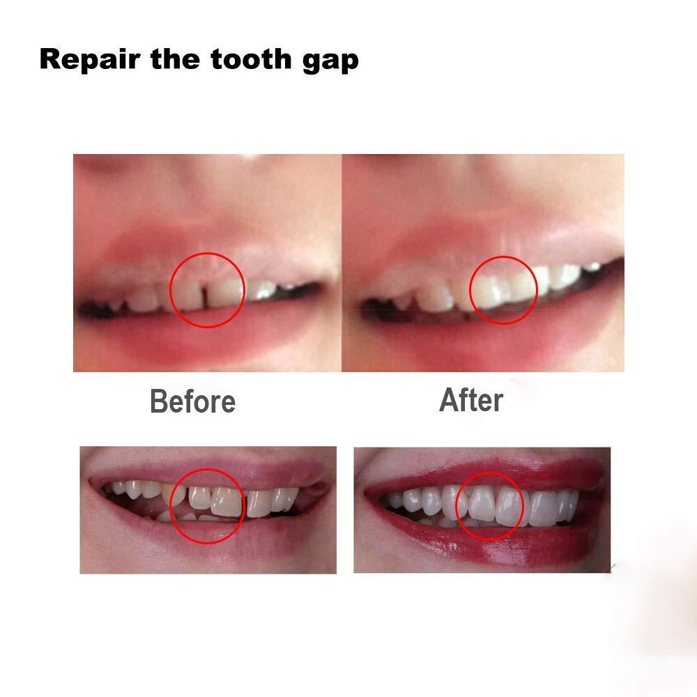 Tooth Repair Kit-Thermal Fitting Beads Granules and Fake Teeth for