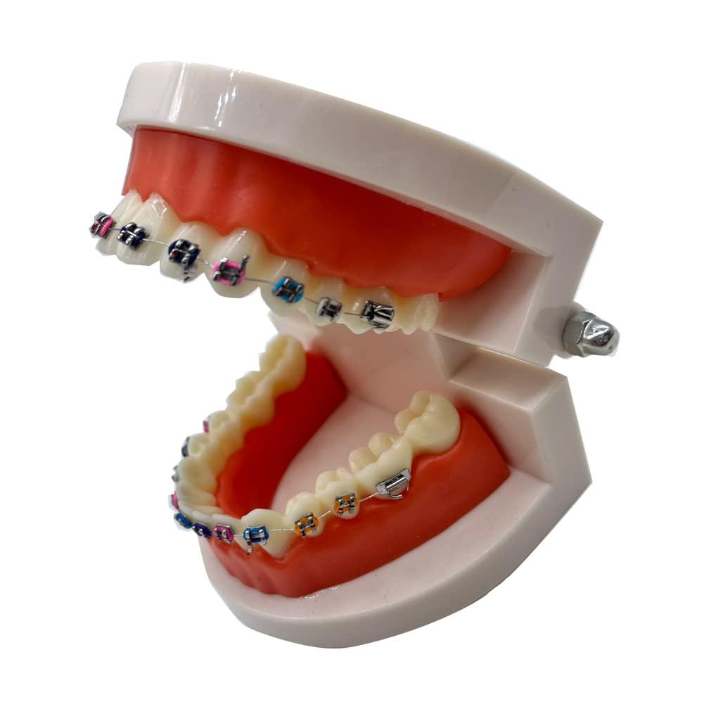 Dental braces made of barb-wire : r/weirddalle