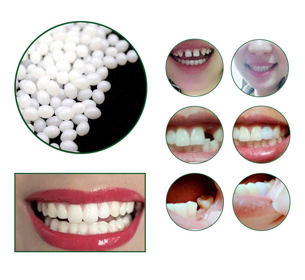 Temporary Tooth Repair Kit False Teeth Solid Glue Denture For Missing  Broken Teeth Moldable Tooth Filling False Teeth Tool