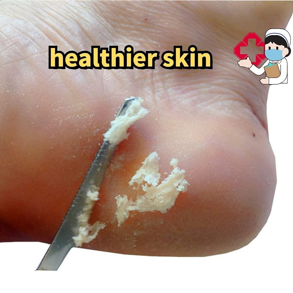 Feet Scraper Knife Manicure Pedicure Pedicure Tool Scraper  Healthwellne,Manicure Kit Scrapercleaner Stainless Steel Foot Care Callus  Exfoliating