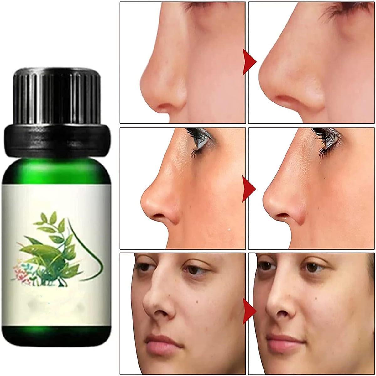 Alkyne Sci-effect Nose Lift Shaping Oil Nose Up Heighten Rhinoplasty  Essential Oil Nasal Bone Remodeling Serum for Nose Heighten&Reshaping (3pcs)