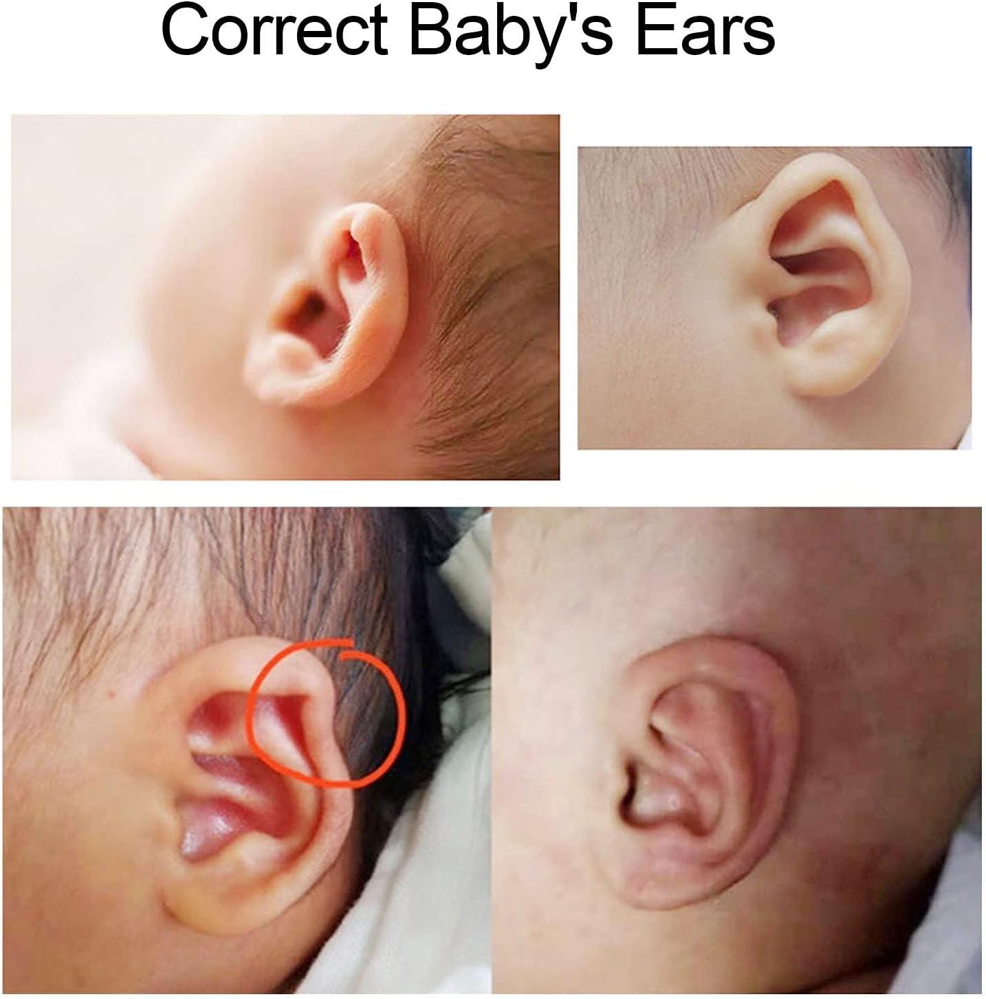 Ear Corrector Correct Deformed Protruding Tape Prominent Ears with
