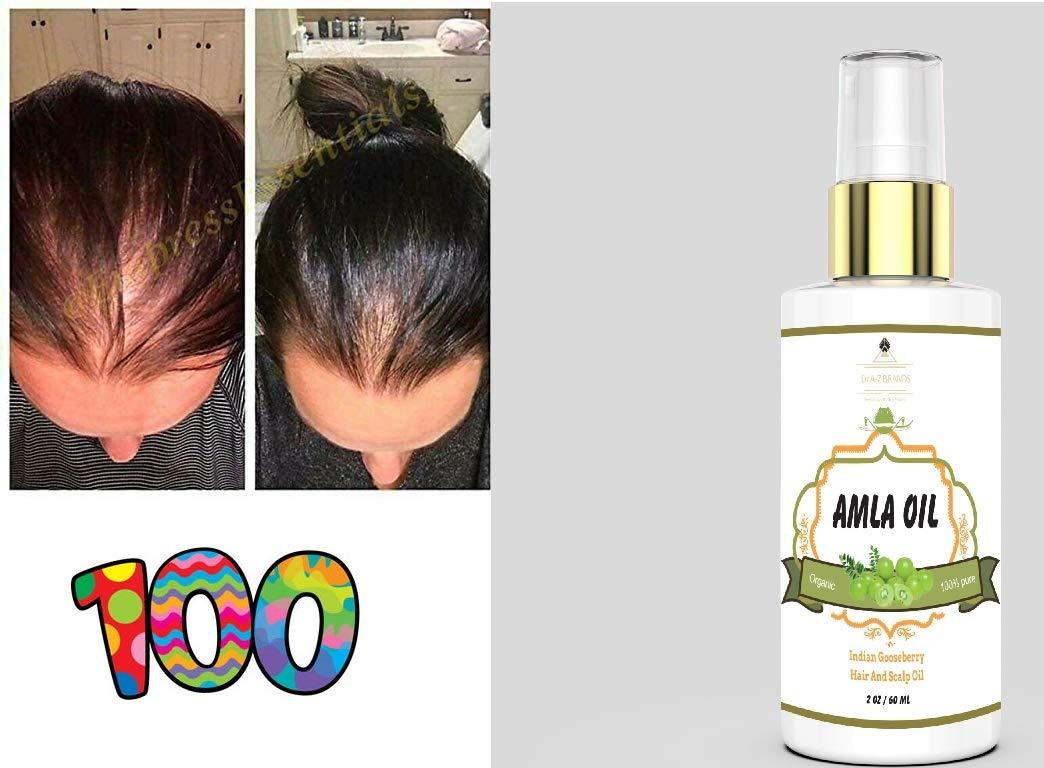 Amla Oil Organic For Hair Growth,100% Pure Amla Hair Oil Nourishes