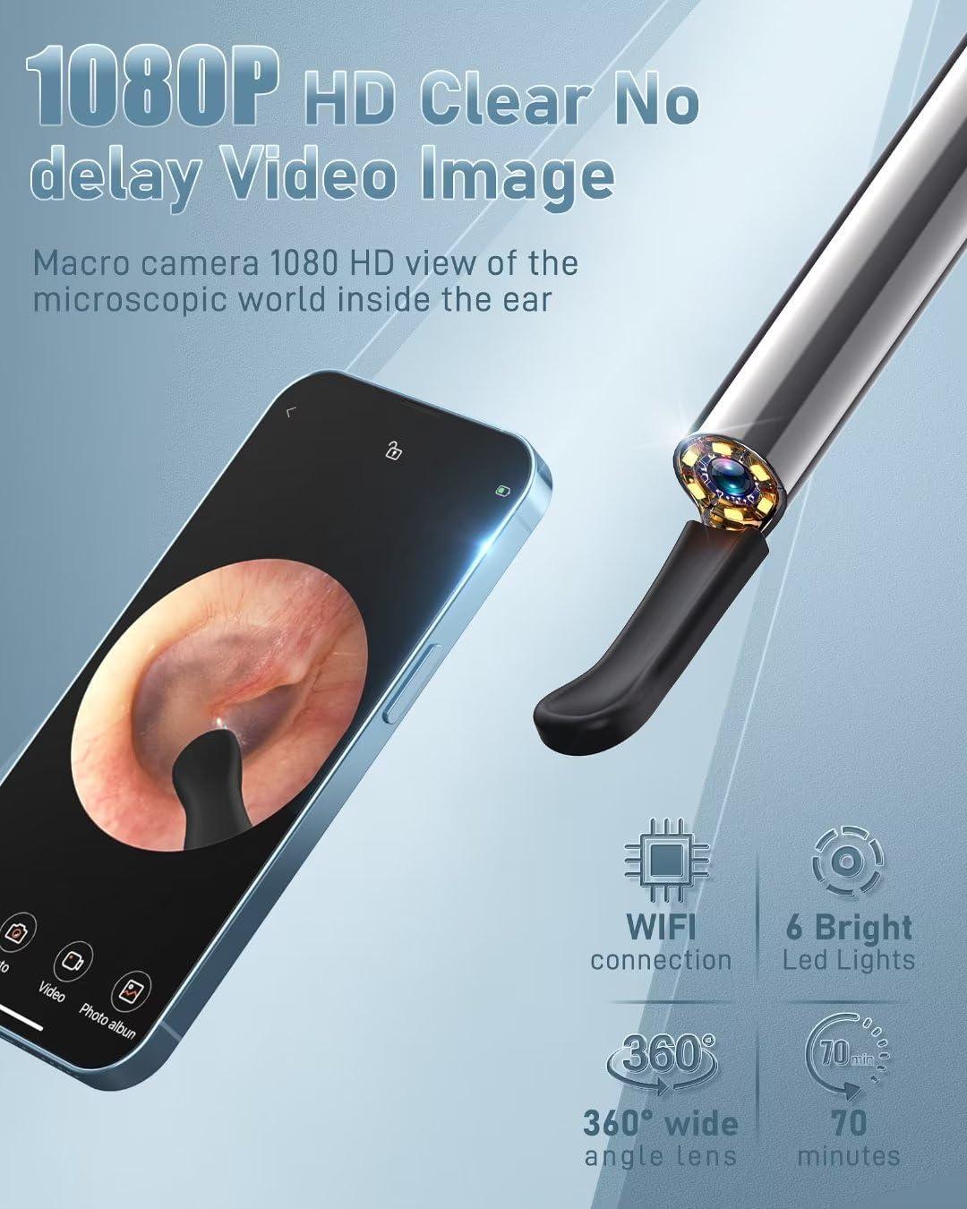 Ear Wax Removal, Ear Cleaner with Camera and Light, 1080P Otoscope
