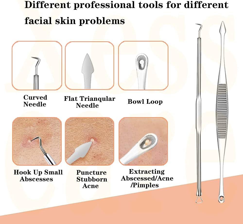 Xesscare Latest Pimple Popper Tool Kit 16 Pcs Blackhead Remover Tool  Comedone Extractor Acne Removal Kit Professional Whitehead Tweezers with  Metal Case for Facial Nose and Forehead (Silver-1)