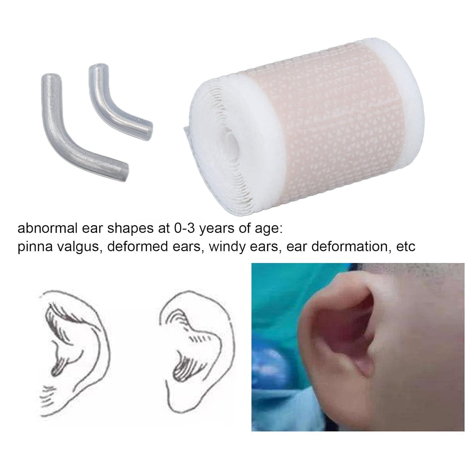 Gel Ear Tape Breathable Ear Corrector Skin Friendly Soft Easy