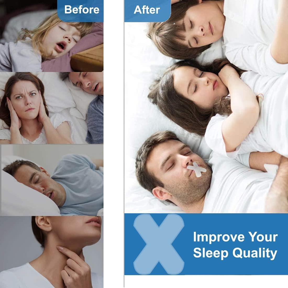 Somnifix Mouth Sleep Solution For Mouth Snoring Advanced Gentle Mouth Tape For Better Nose