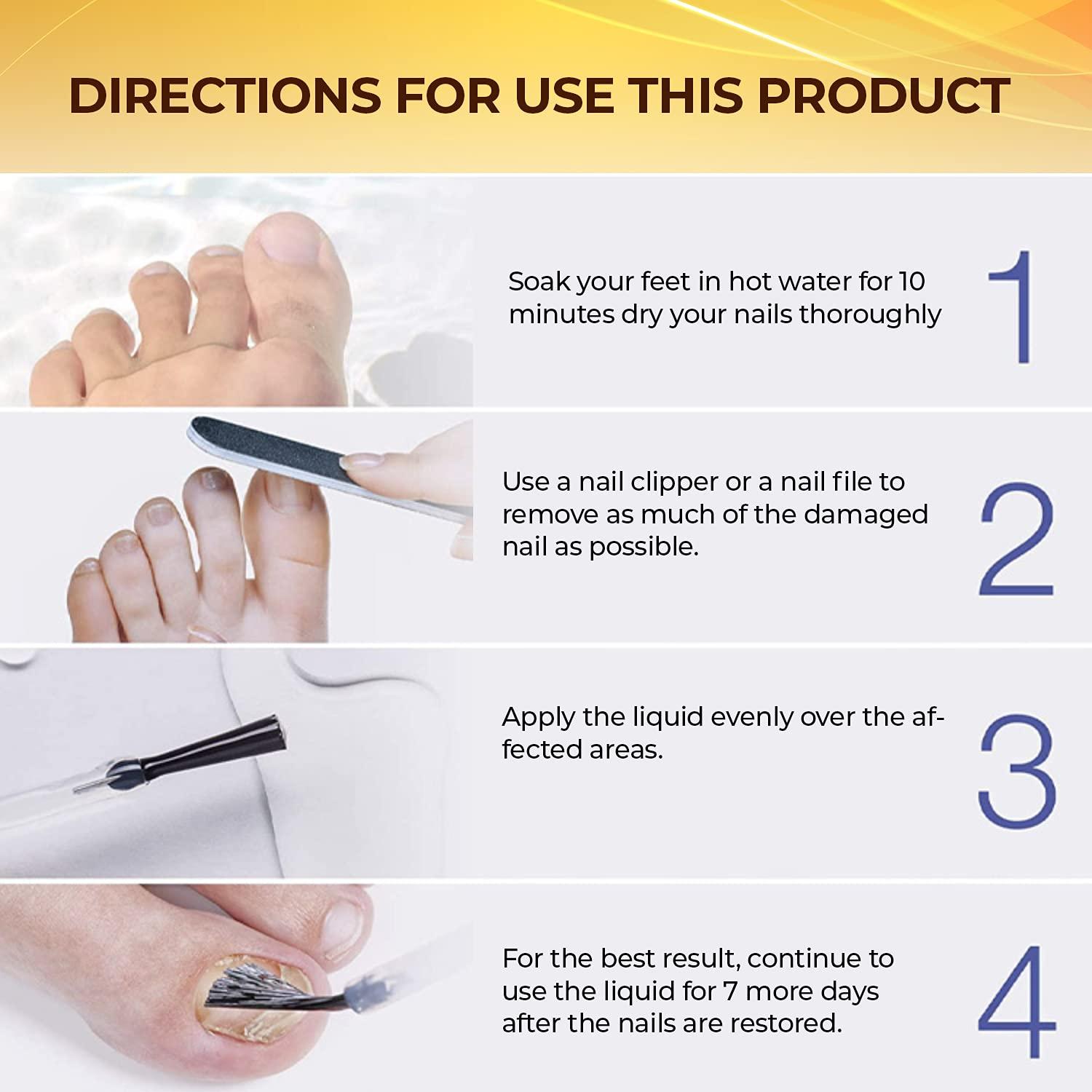 Nail Repair Treatment for Toe and Fingernail Fungal Repair Maximum ...