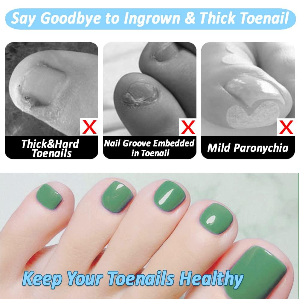 Podiatrist Toenail Clippers for Thick Nails, Professional Ingrown