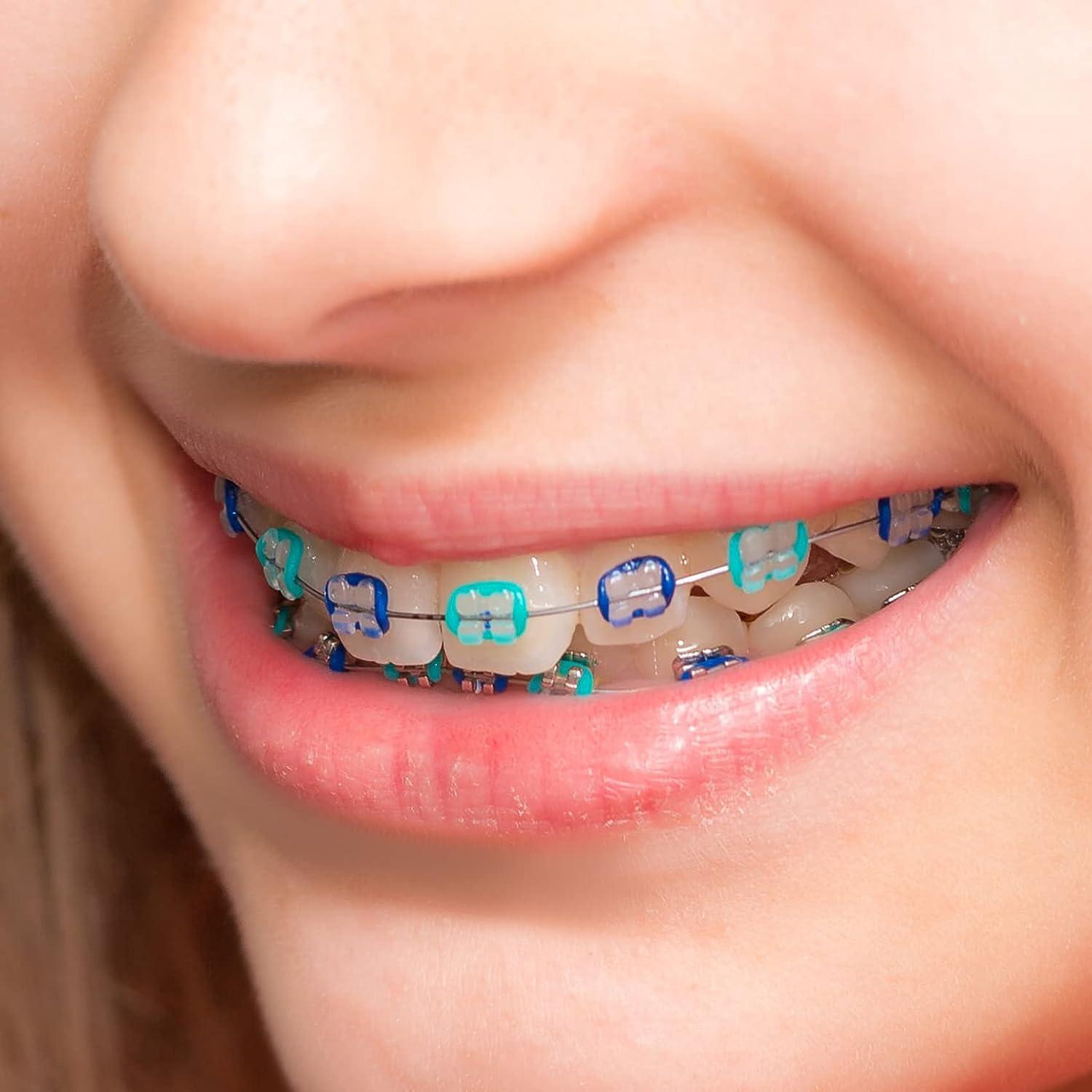 Dental Orthodontic Elastic Ligature Ties Braces Rubber Bands 1040pcs/bag  Purple
