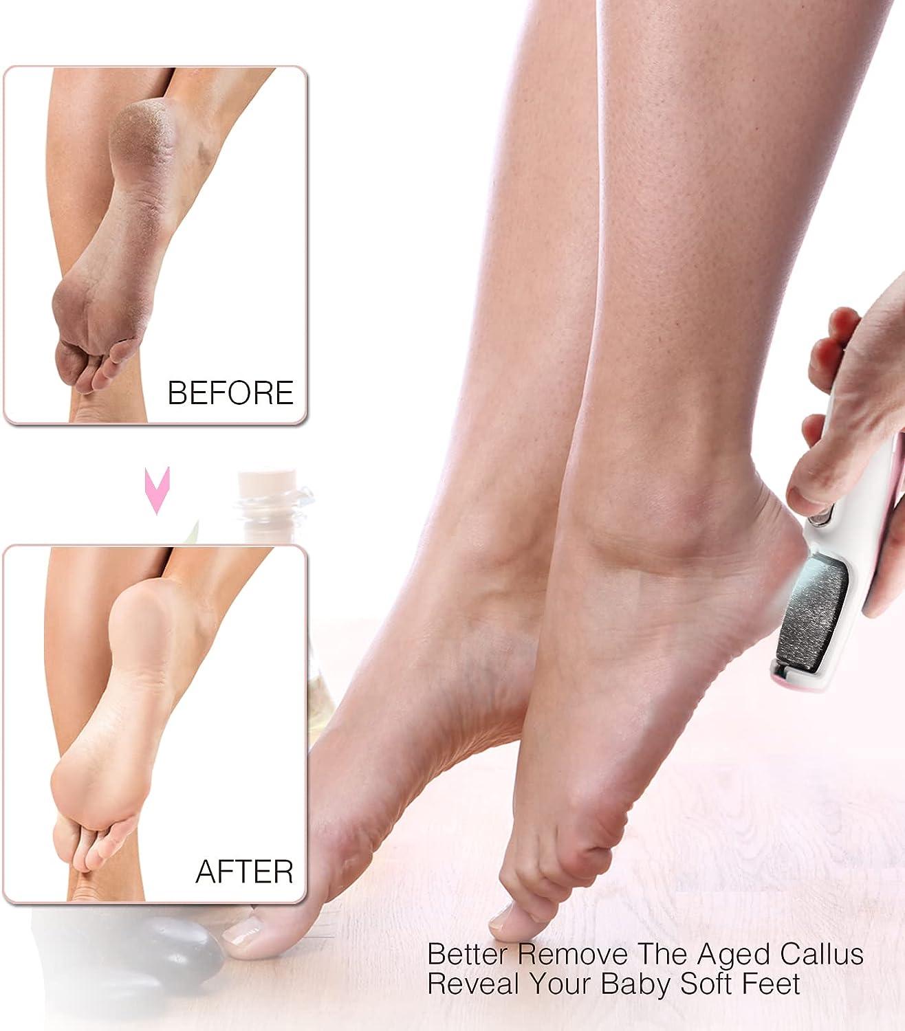 Electric Foot File Callus Remover Feet Professional Pedicure Tools Foot Feet  Removal Hard Cracked Dead Skin Remover Foot Care