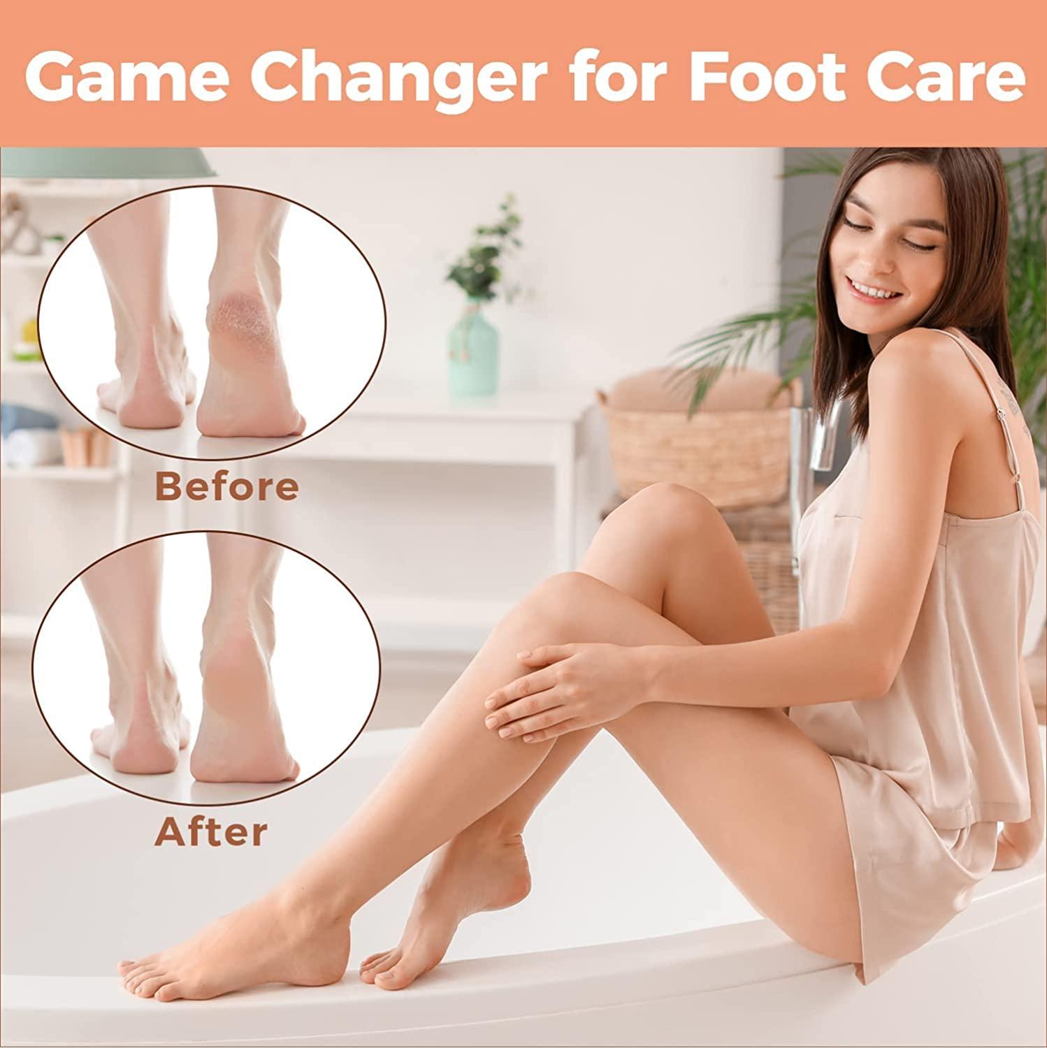 Wholesale Foot Pedicure File Hard Skin Remover Use Wet Dry HN216