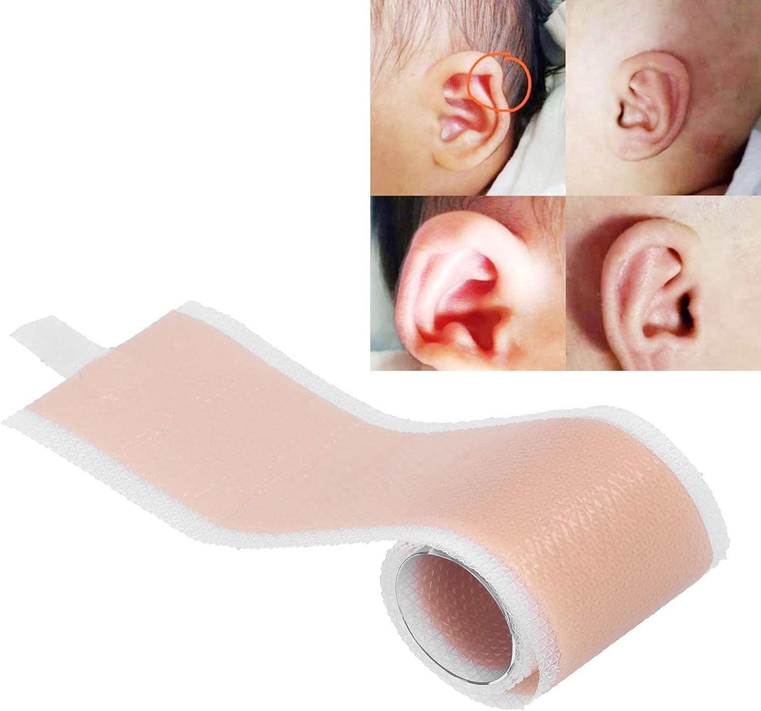 Ear Corrector Contain 30 Ear Tape Solve Big Ear Problem with Ear Stickers  by Pinning Back Ears Cosmetic Aesthetic Correctors for Prominent Ears  Waterproof Ear Correctors Sticks for Adults