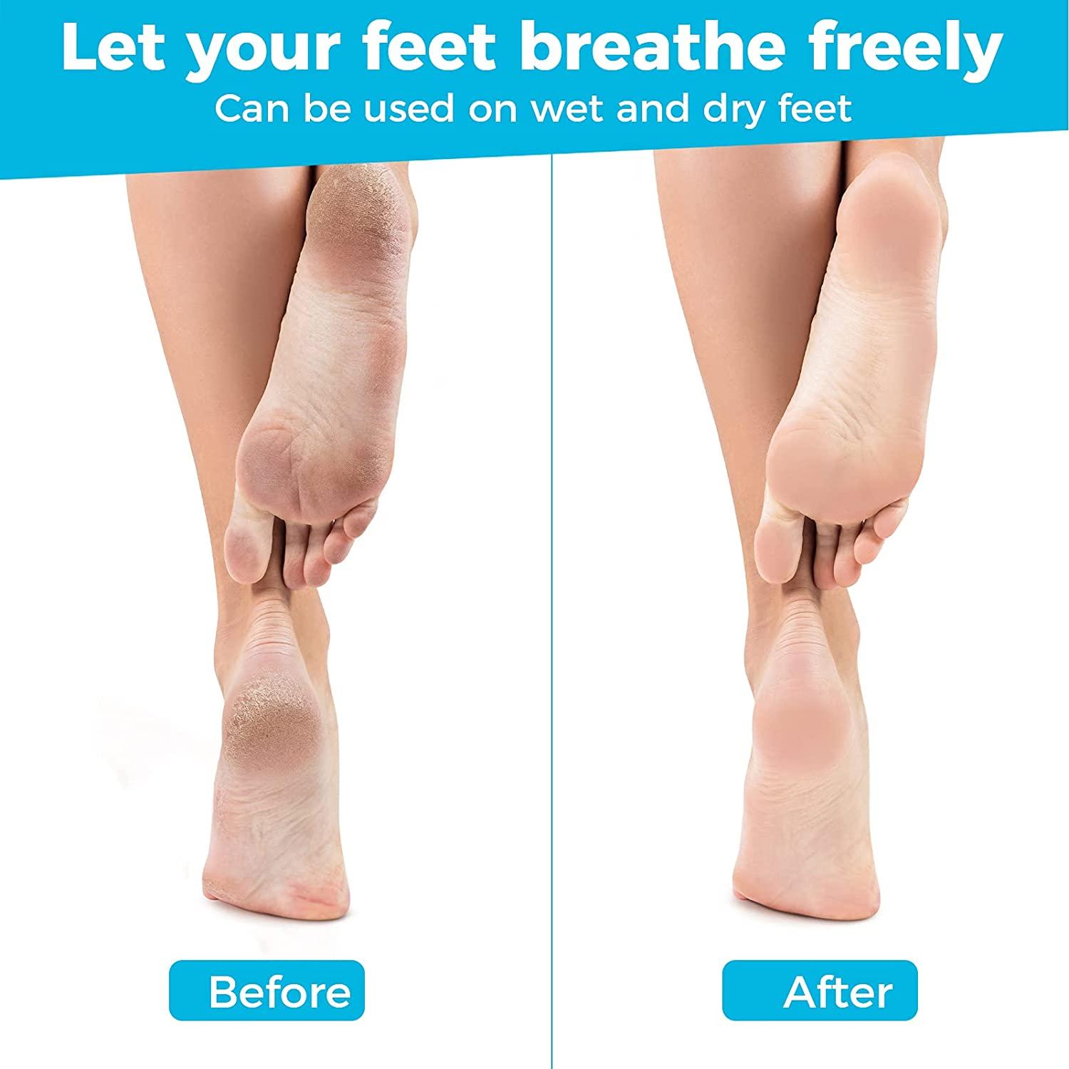 Foot File by Joovre, Best Callus Remover for Dry and Wet Feet, Exfoliates,  Removes Hard Skin