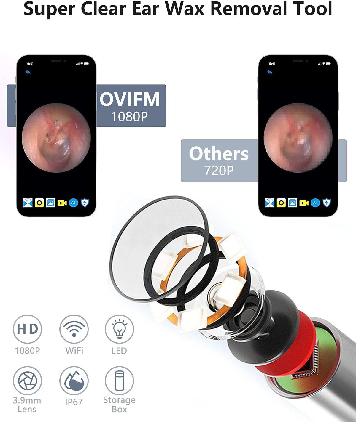 Sans fil HD Ear Wax Remover Caméra Ear Endoscope Spoon Pick Kit d'outils de  nettoyage