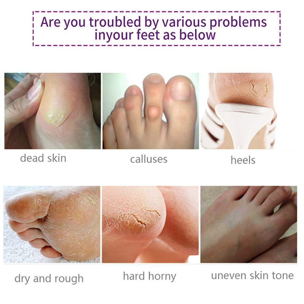 How to Get Rid of Hard Skin on Feet, Exfoliating