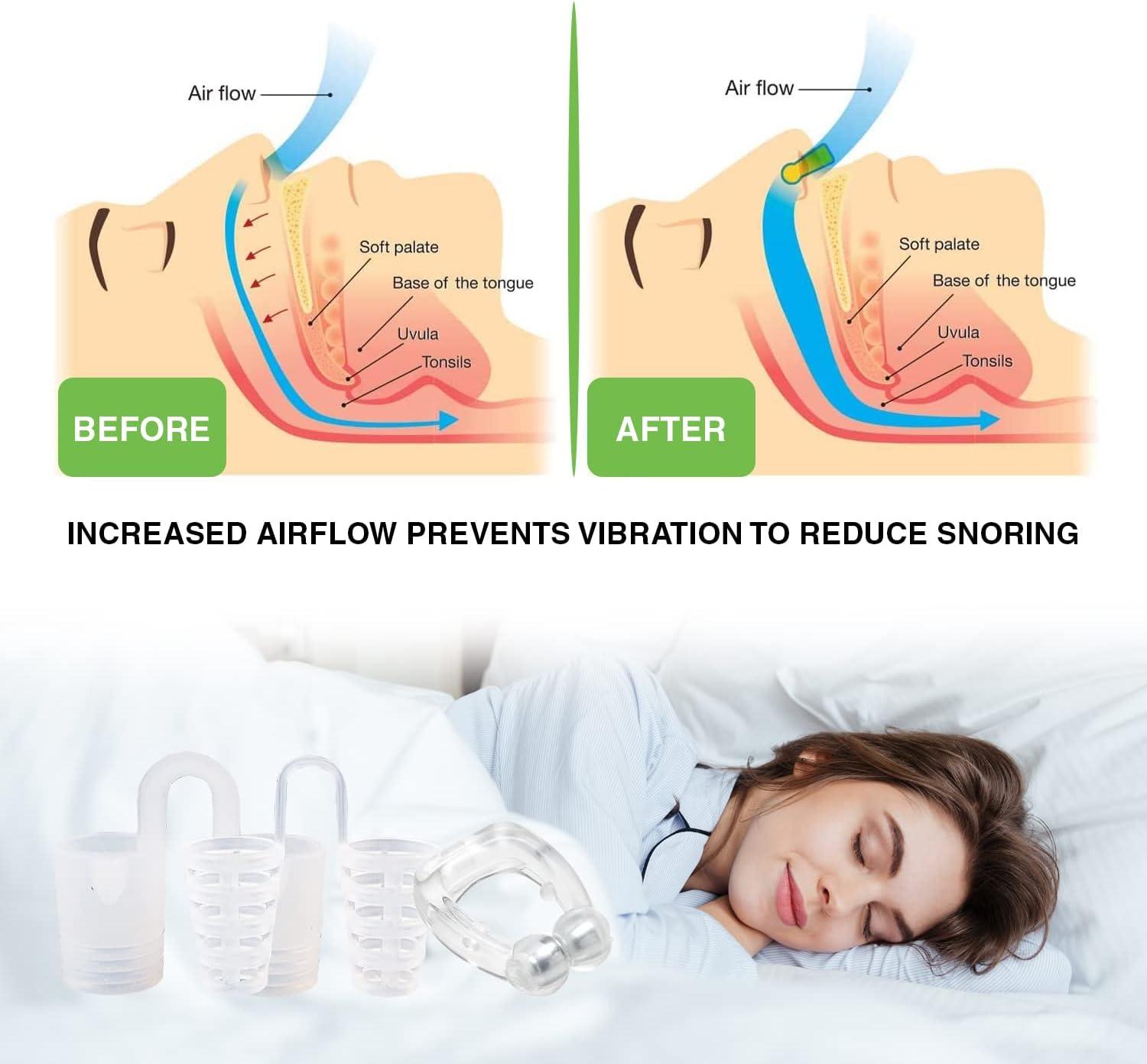 snoring Device Silicone Tongue Cover for Mouth Snoring Solution for Better  Nighttime Sleeping