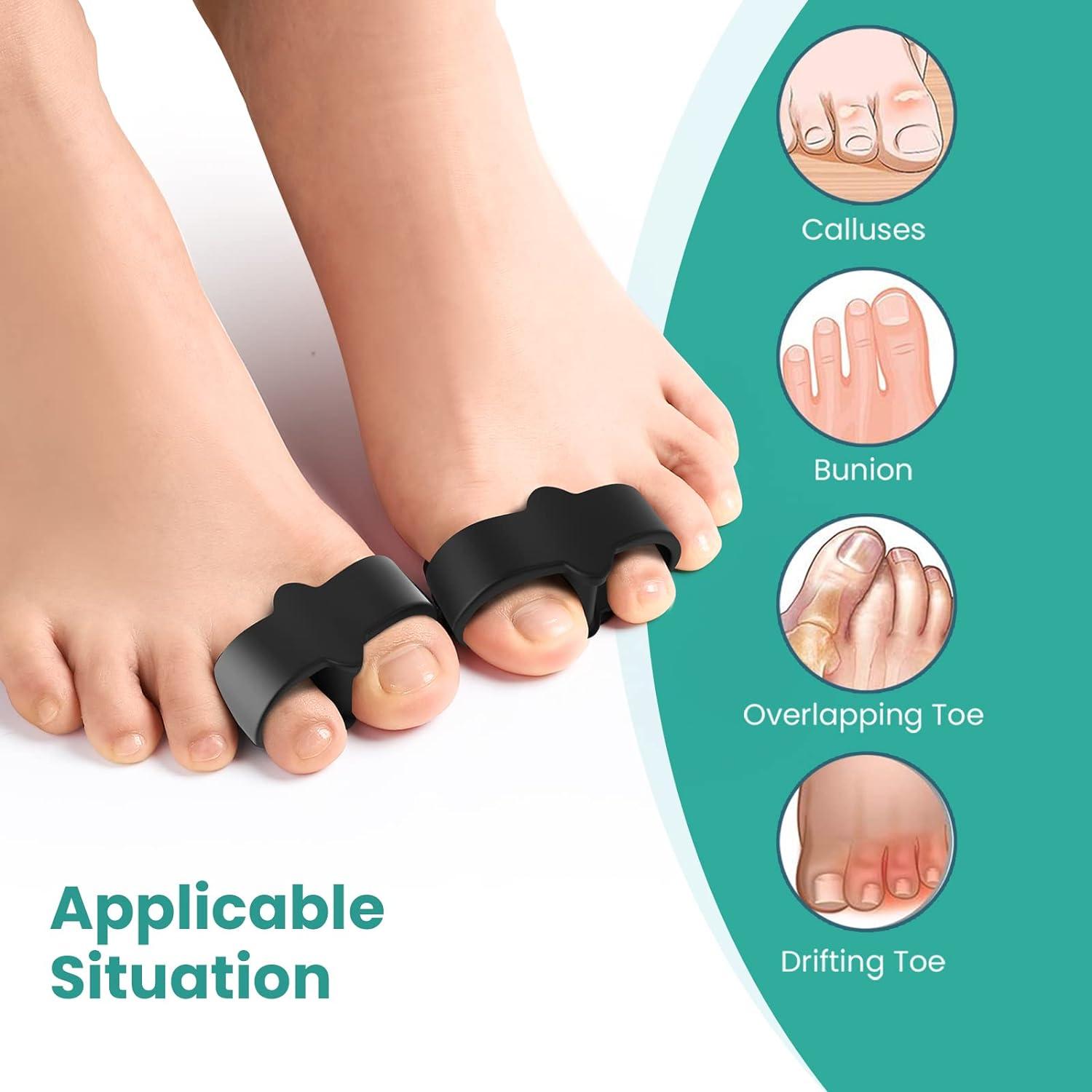  Welnove Toe Separator Bunion Corrector- 8 Pack Toe Straightener  for Women Men Overlapping Toes - Toe Spacers for Nighttime, Running & Yoga  Practice（Black/Blue*8） : Health & Household