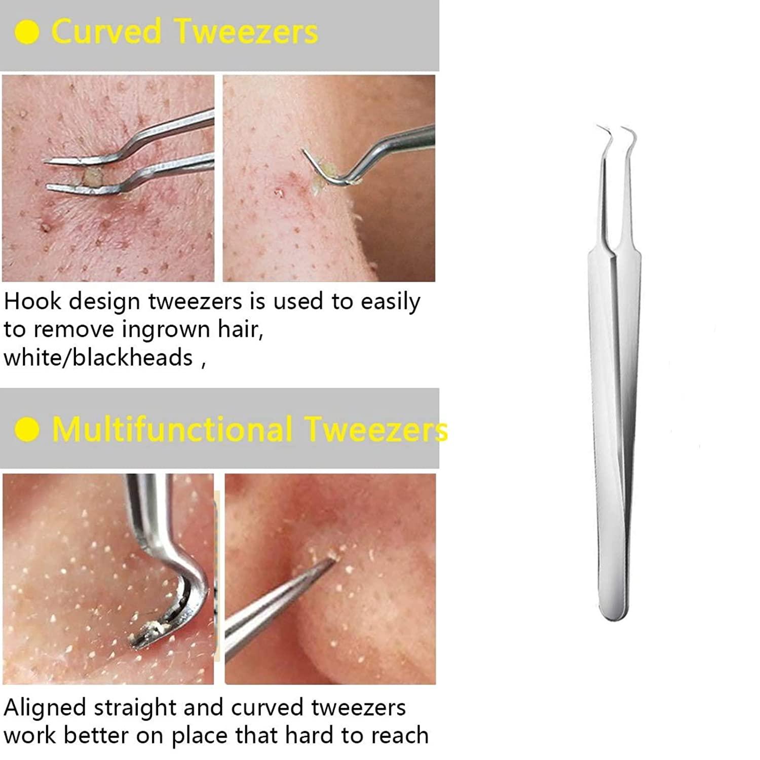 Ultra-Sharp Curved Hook Extractor For Blackhead, Acne, Pimple Removing And  Cleaning Tool