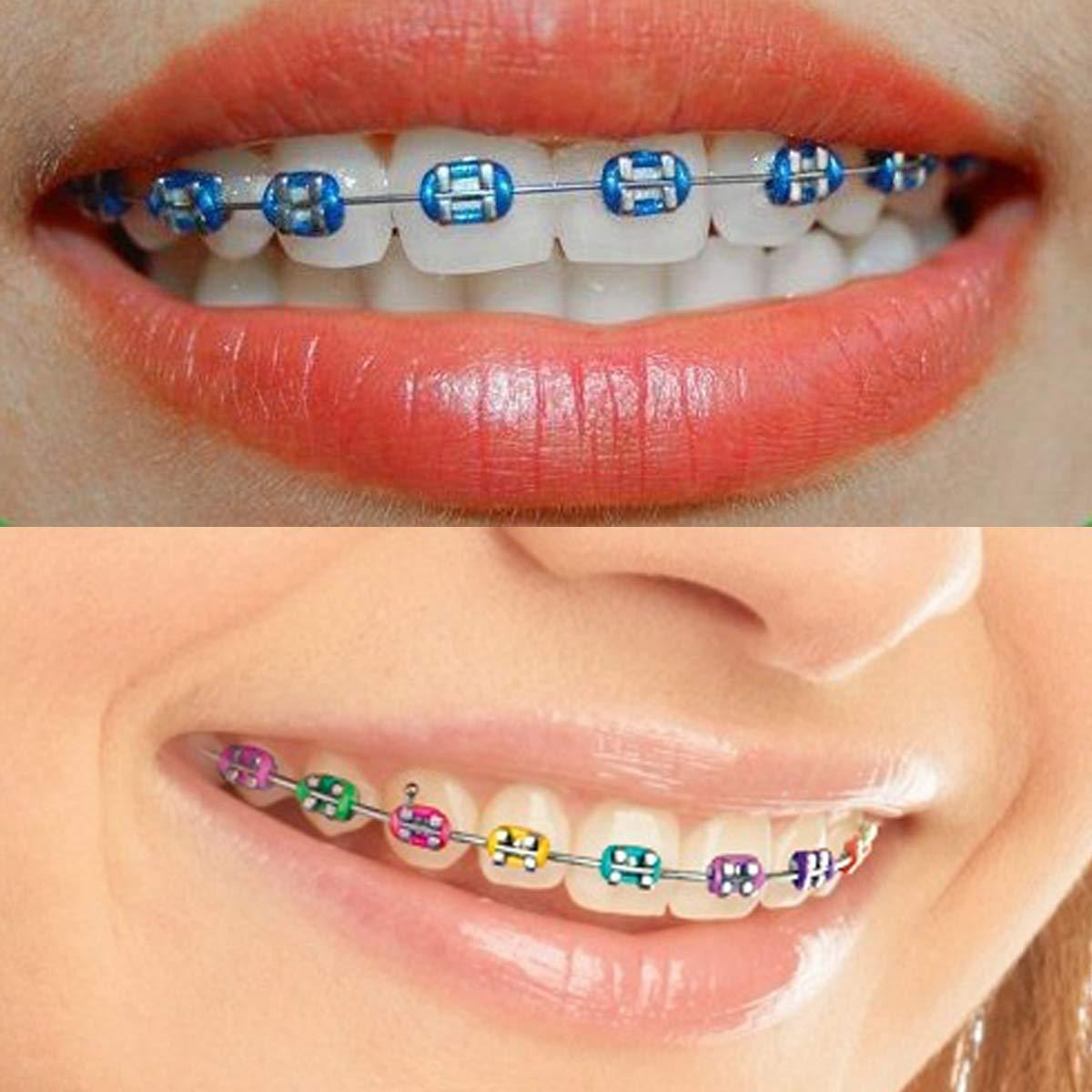 1040 Pcs Multicolored Braces Rubber Bands Orthodontic Ligature Ties O-Rings  Elastic Bands for Braces (Color)