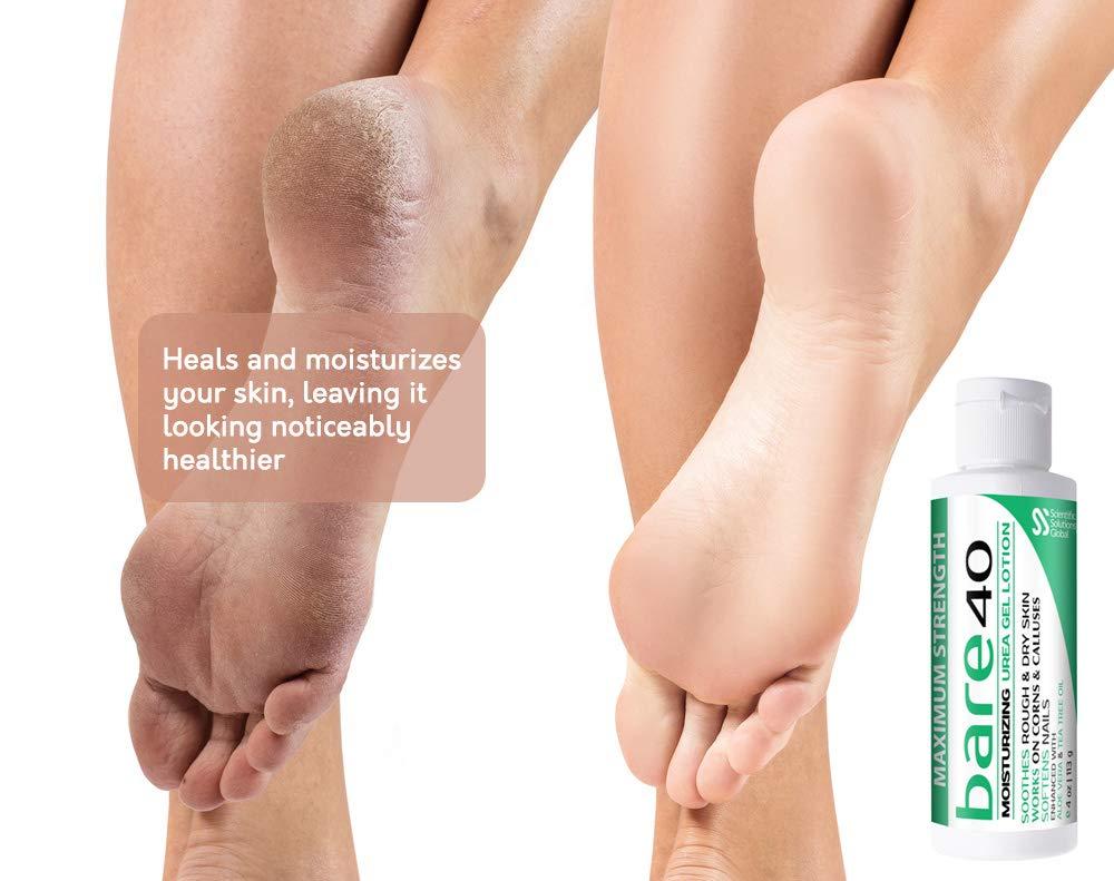 143 Cracked Heel Cream Stock Video Footage - 4K and HD Video Clips |  Shutterstock