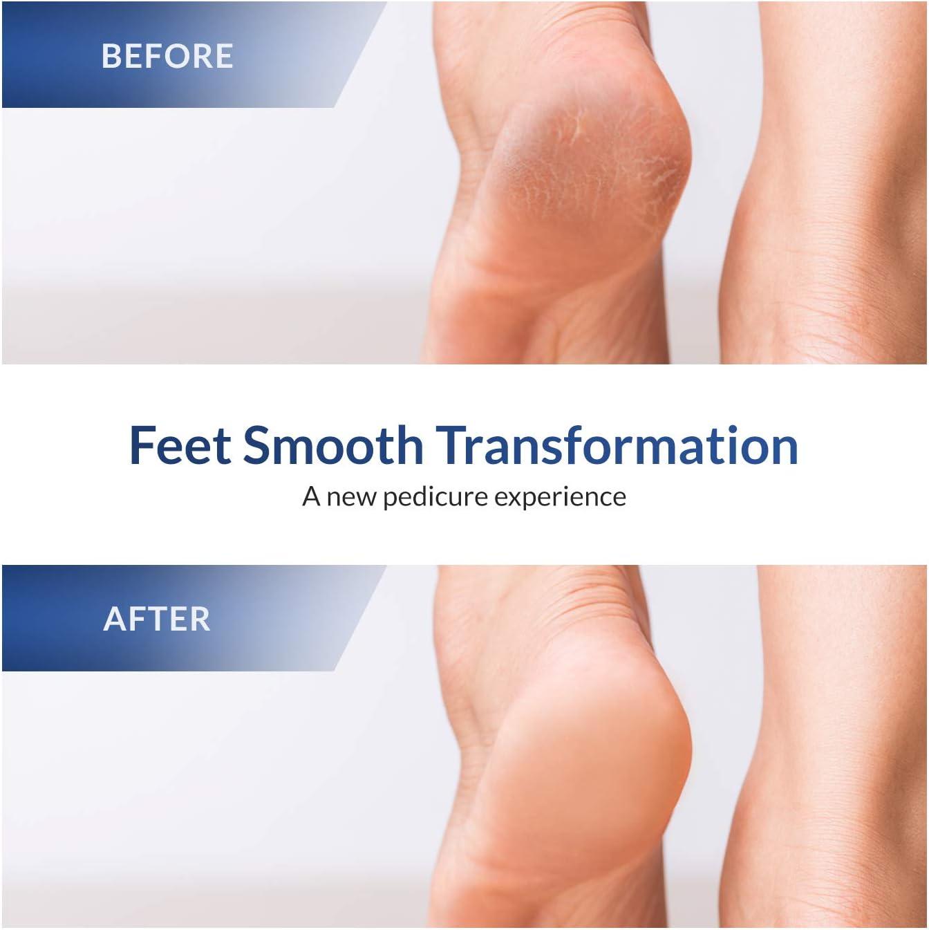 Smooth Feet Tutorial: How To Use The Glamscious 2 In 1 Foot Rasp