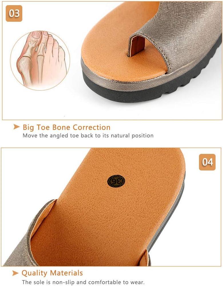 Do Bunion Corrector Sandals Work Long-term? | The Bunion Cure