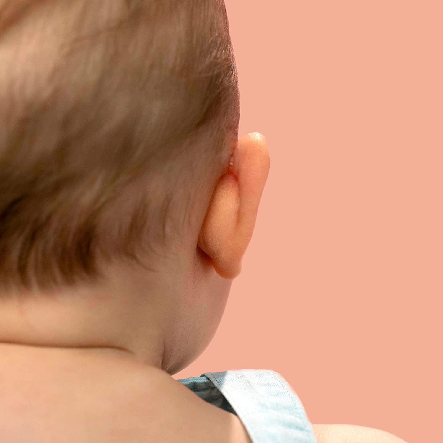 8 UDS Baby Otostick Pack + Cap. Ear Concealer. Ear Concealer.