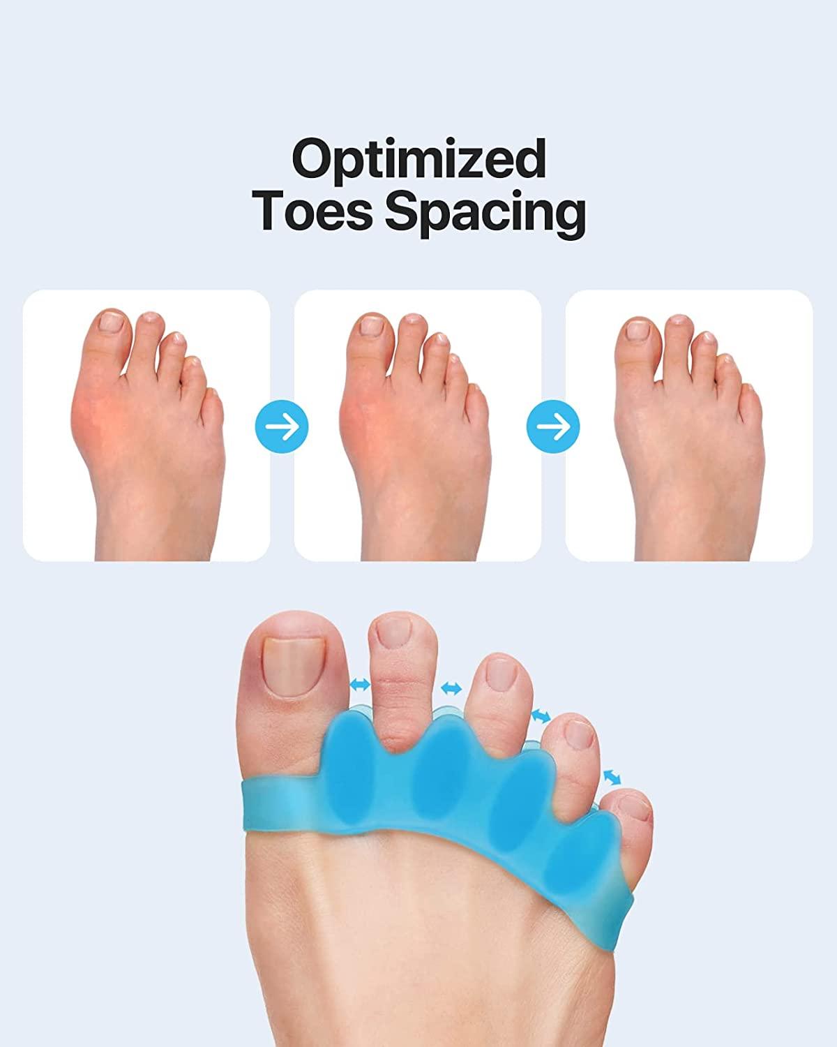 Toe Separators-Toe Straightener-Yoga Toes Toe separators,Toe spacers for  Men,Toe spreaders for Women,Bunion Correction-for Hammertoes,Plantar