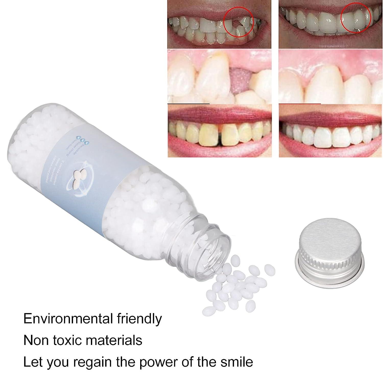 Mamamax Temporary Tooth Repair Kit,Temporary Filling for Tooth Suitable for  Multiple Teeth,Broken Teeth, Missing Teeth,Halloween Dentures 