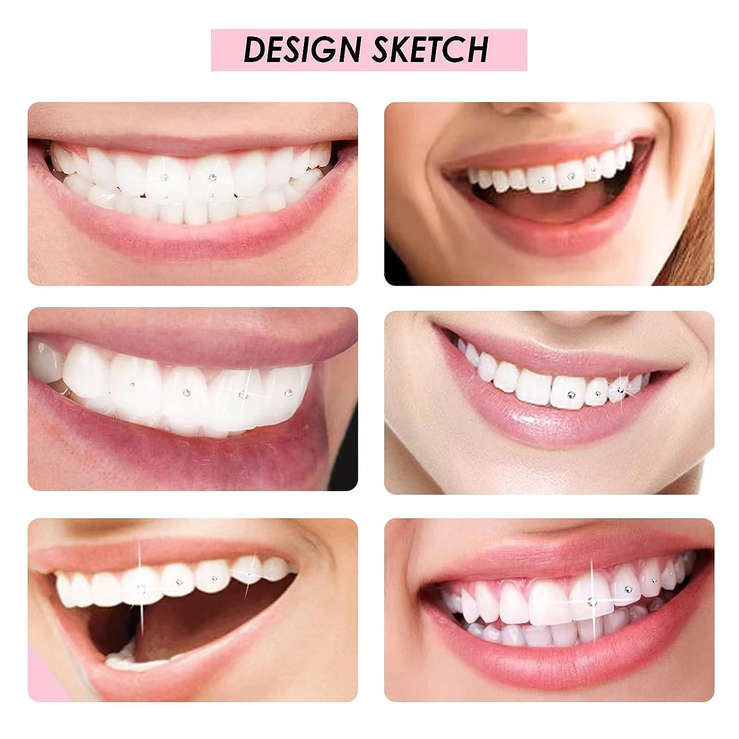 Professional DIY Tooth Gem Kit, Tooth Gem Starter Qatar