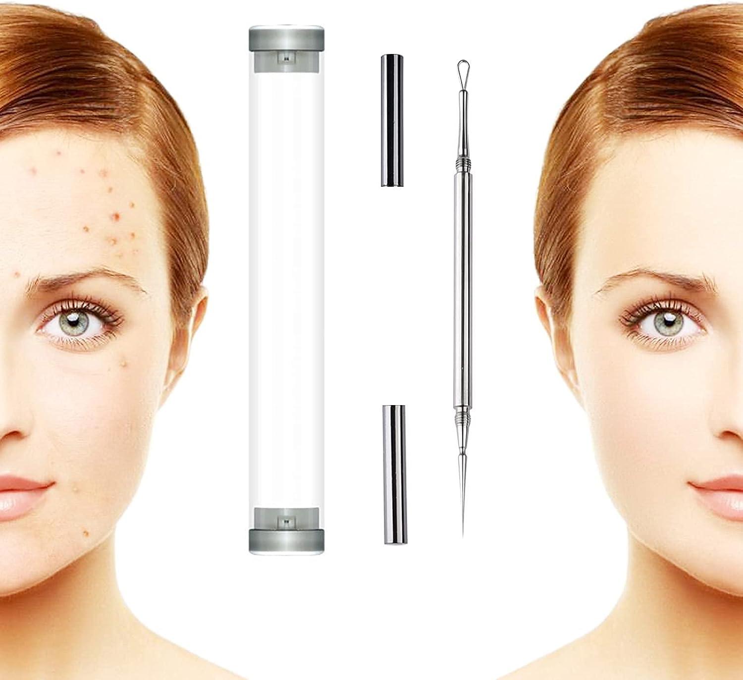 Professional Facial Milia Removal and Whitehead Extractor