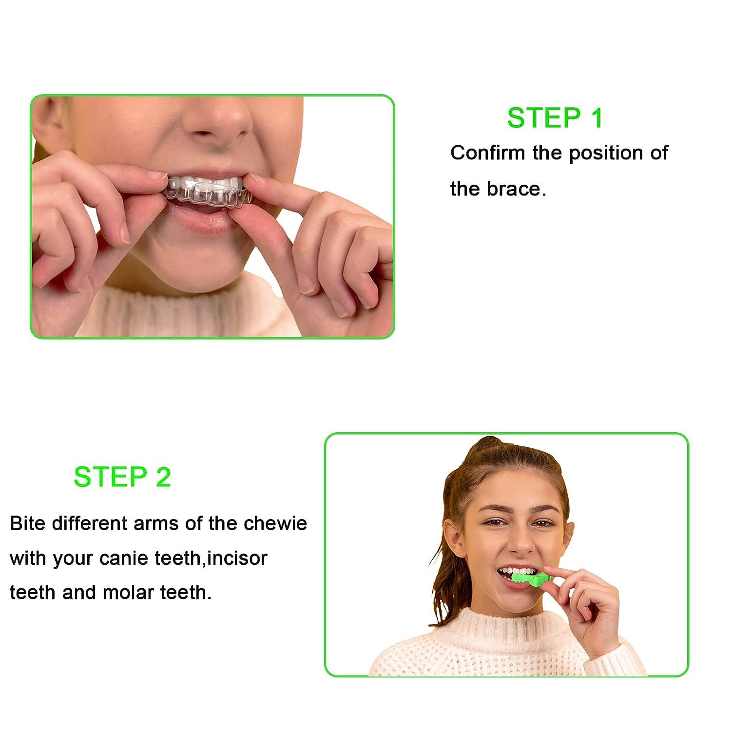  Aligner Chewies for Invisalign, 2 PCS Y-Shaped Chewies for  Invisalign Trays Seater Invisible Braces Orthodontic Munchies Dental  Chewies (Green/Mint Flavor) : Health & Household