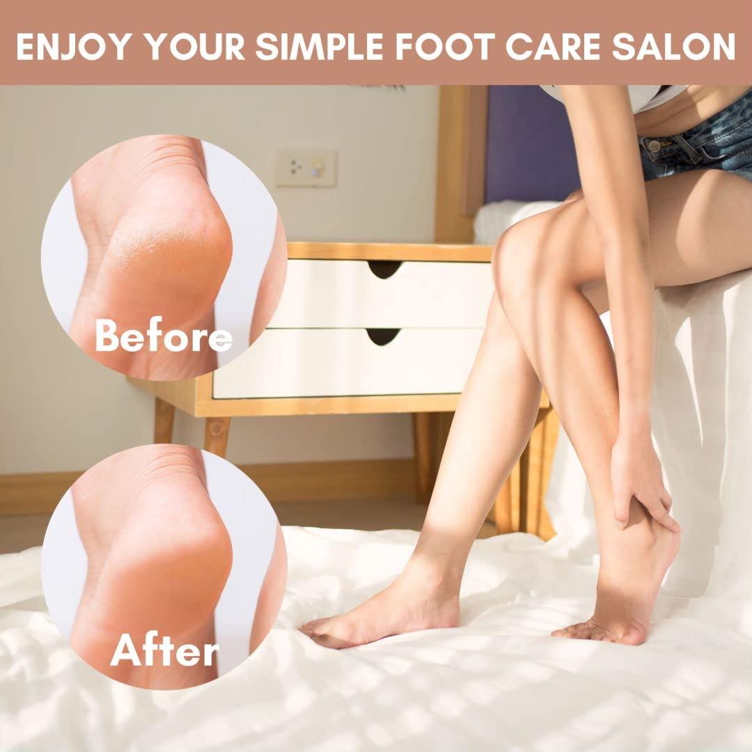 How To Use A Foot File - DIY Foot Care For Men To Guarantee Callus Removal  and Exfoliation 